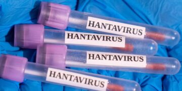 Ruski virusolog upozorava na potencijalne nove, opasnije varijante hantavirusa