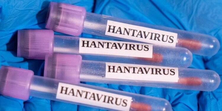 Ruski virusolog upozorava na potencijalne nove, opasnije varijante hantavirusa