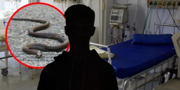 Dečaka ujela poskok dok se igrao u kampu na Jadranu